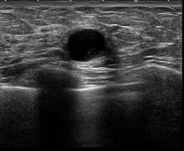 前回の健診の結果からオプション検査を考えてみる〜胃がんと乳がんの検査結果を例に〜 府中クリニック